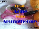 Thumbnail How to Treat Acne with Aromatherapy