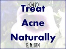 Thumbnail How to Treat Acne Naturally