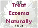 Thumbnail How to Treat Eczema Naturally